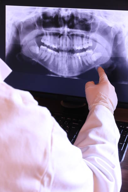 Best Emergency Root Canal Treatment in Dell Rapids, SD