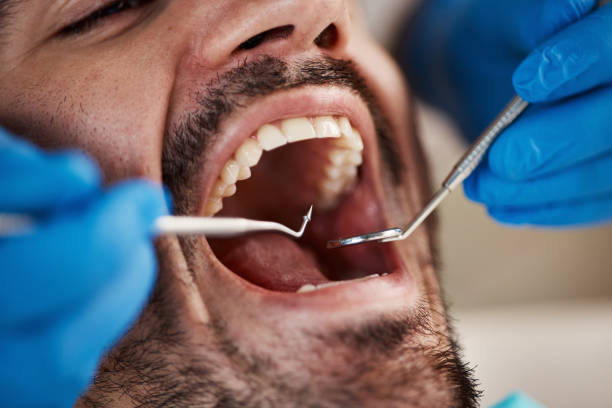 Best Emergency TMJ Treatment in Dell Rapids, SD